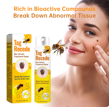 Skin Wart Tag Removal Cream Price in Pakistan