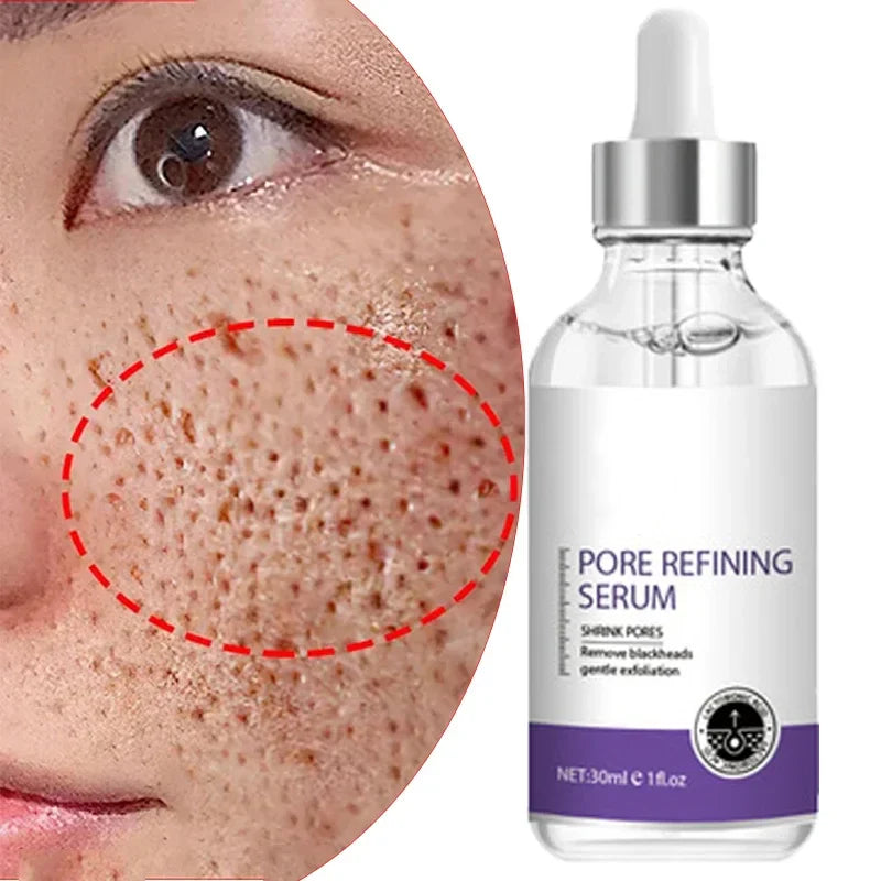 Radiant Skin Renewal - Pore Refining & AMP - Brightening Facial Serum with Retinol and Niacinamide (Non-Comedogenic) - Pore Refining &amp; Brightening Facial Serum Price in Pakistan
