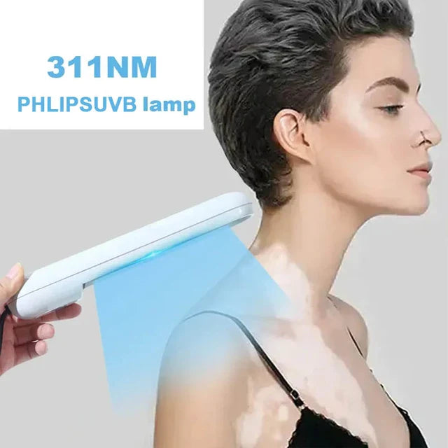 311nm UV lamps Phototherapy - Treatment Lamp - For Vitiligo Psoriasis Treatment