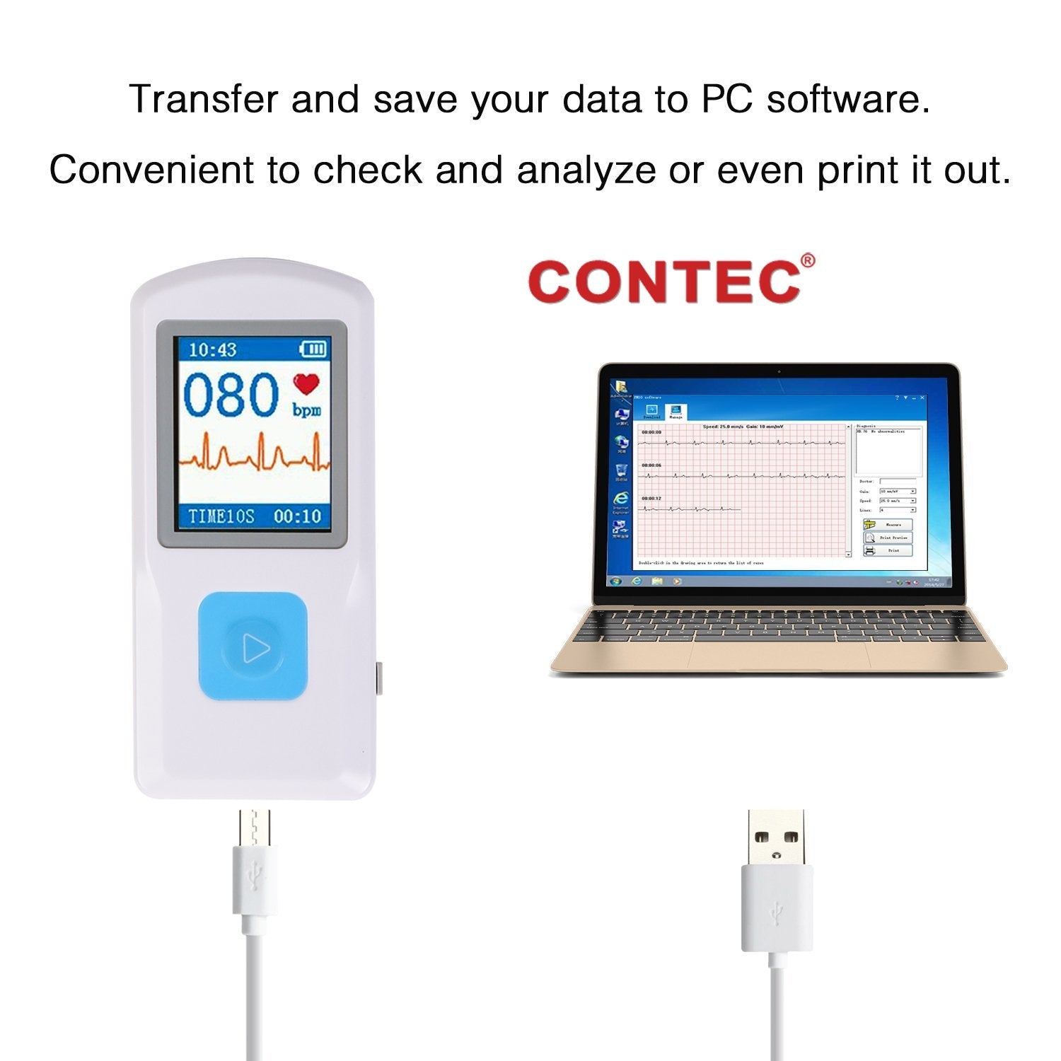 CONTEC PM10 Portable ECG Monitor, Bluetooth Transmission, Color TFT-LCD
