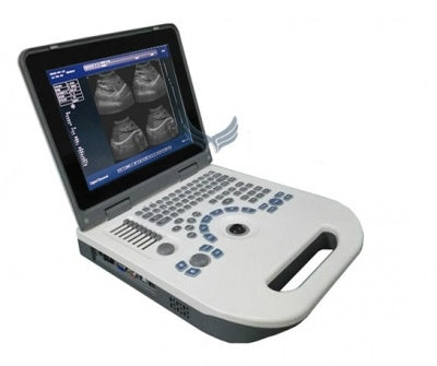 NYRO 10 Portable Ultrasound Machine – Novadex Nyro 10 – Novadex Nyro 10 - Laptop Type Battery Operated Ultrasound Machine - Ultrasound Machine Prices in Pakistan