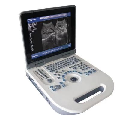 NYRO 10 Portable Ultrasound Machine – Novadex Nyro 10 – Novadex Nyro 10 - Laptop Type Battery Operated Ultrasound Machine - Ultrasound Machine Prices in Pakistan