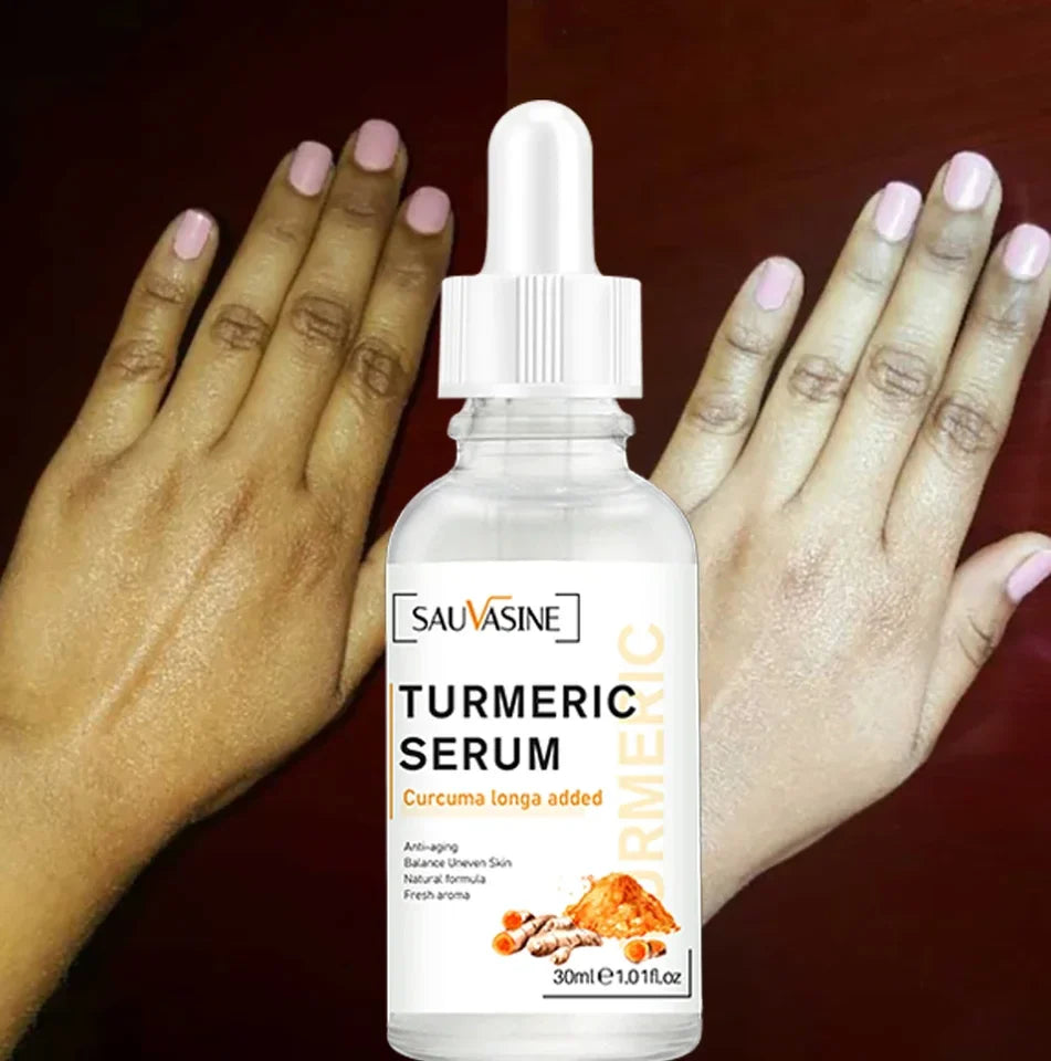 Turmeric Face Whitening Serum Price in Pakistan – Glowing Skin Care