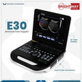 Best E30 Color Doppler Notebook Ultrasound Machine Supplier in Pakistan
