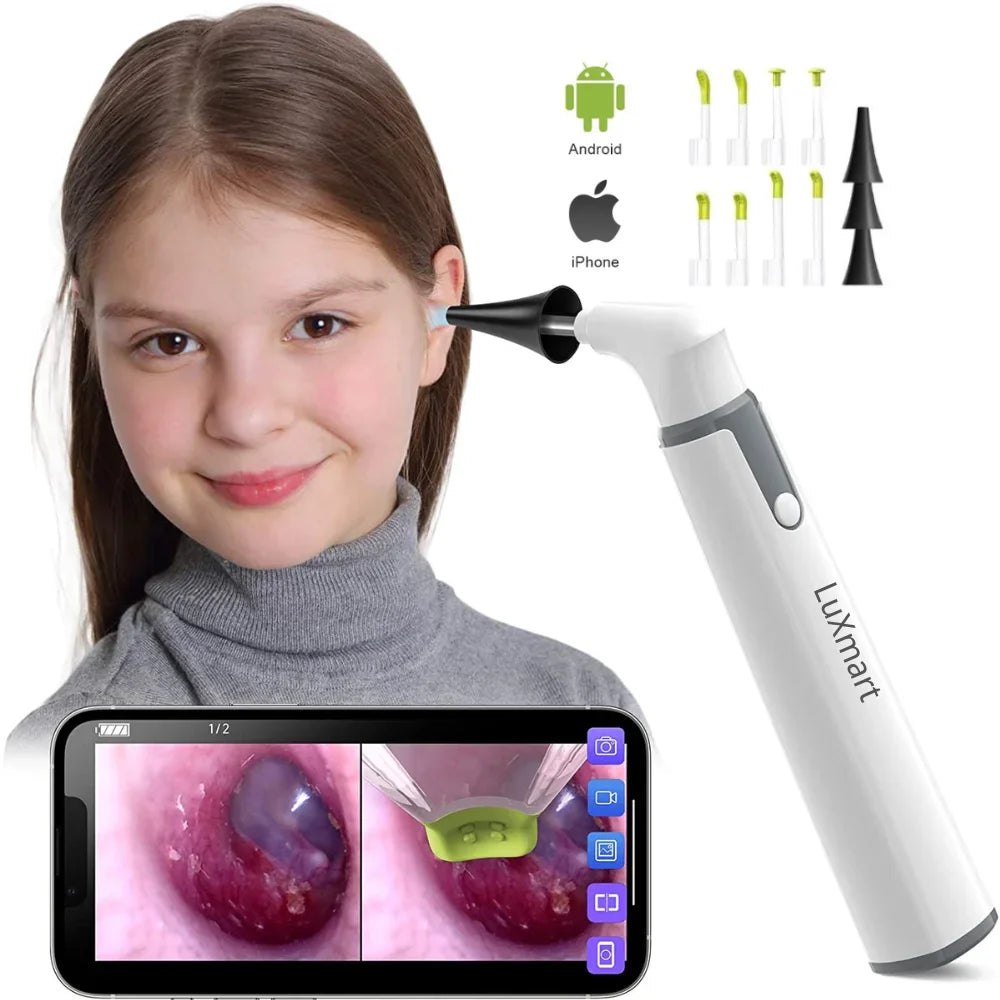 Wireless Otoscope Ear Camera Price in Pakistan