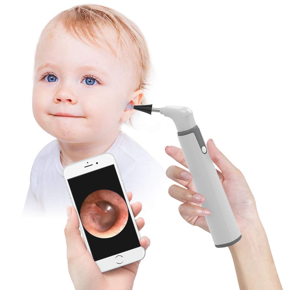 Wireless Otoscope Ear Camera Price in Pakistan
