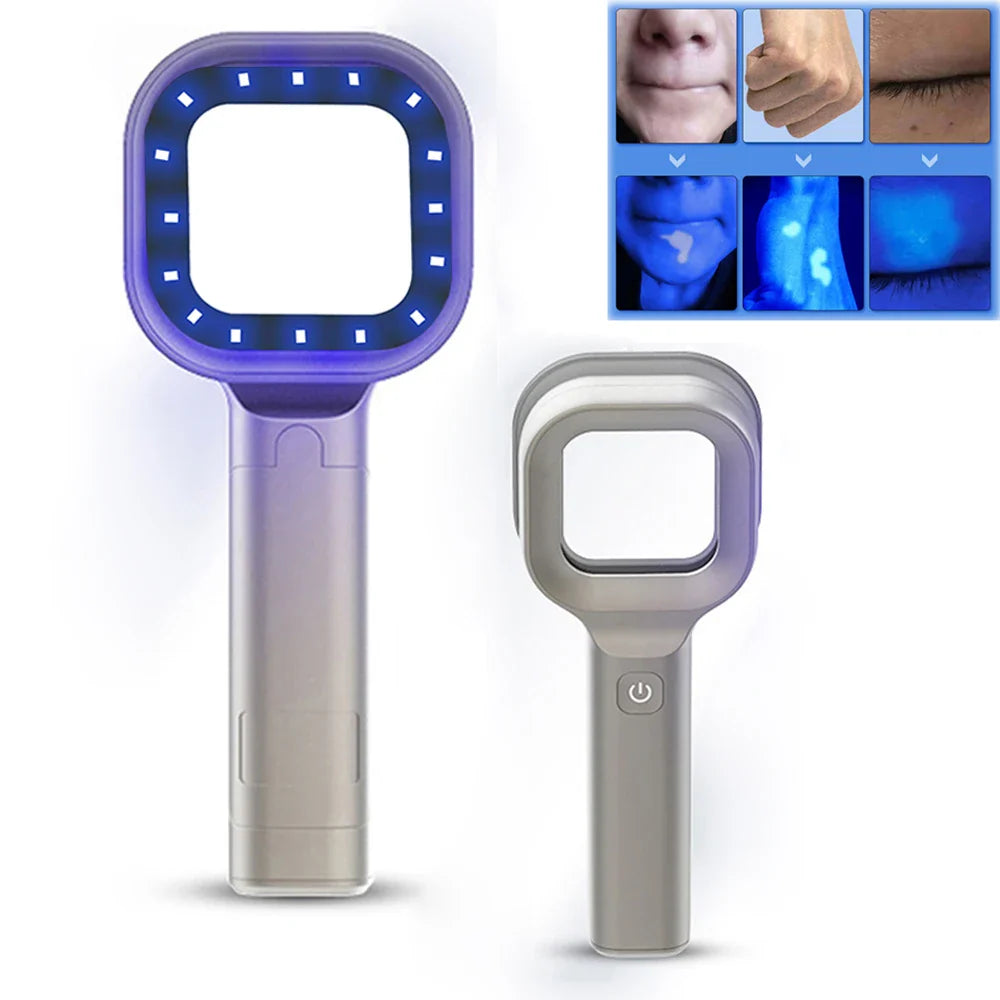 Woods Lamp For Skin Analyzer Machine - UV Skin Examination Beauty Test - Woods Lamp For Skin Analyzer Machine Price in Pakistan